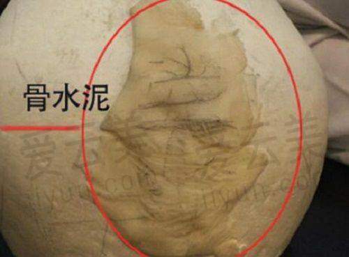北京牙管家口腔诊所 2025 年价格表
