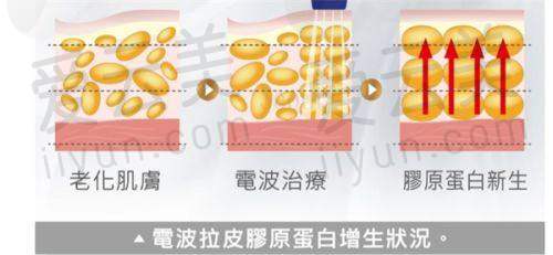 特色项目
