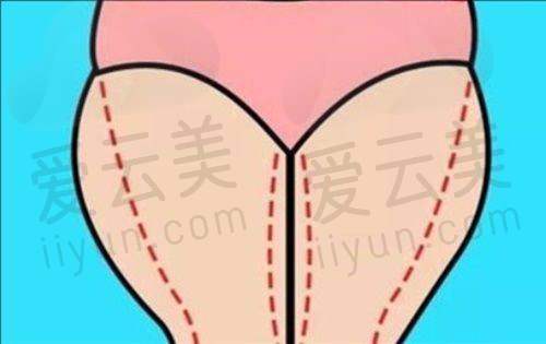 擅长项目介绍