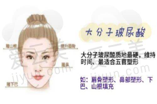收费透明化优势