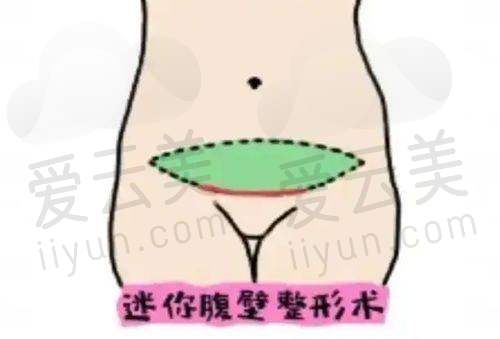 特色整形项目及价格