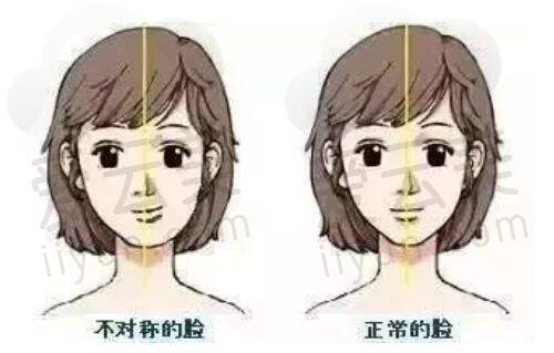 双眼皮项目