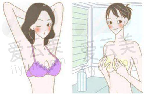 吸脂项目