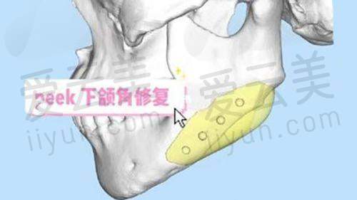 信阳修形美林整形怎么样？对比河南排名前十整形医院，结合医生技术和口碑看值不值
