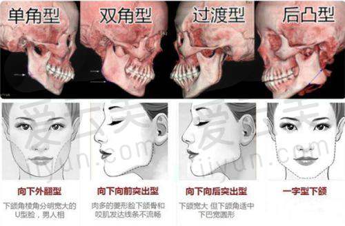 对医院靠谱性的综合考量
