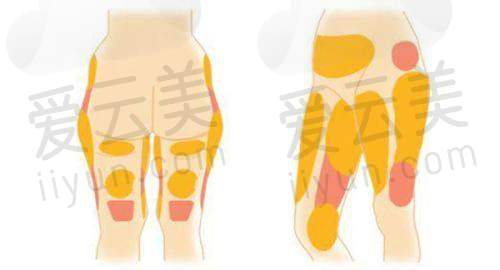 医生团队