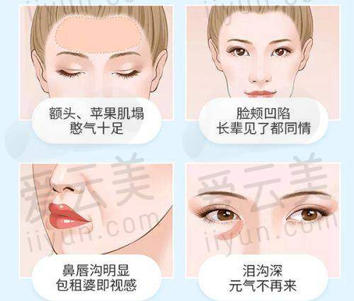 热门项目 - 微拉美埋线提升