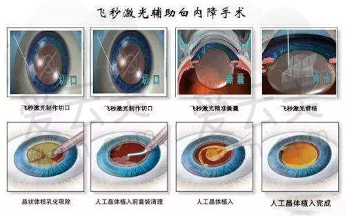 郑州欧华医疗美容医院2025年价格表
