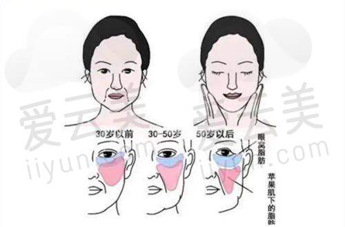 上海美莱吴海龙医生