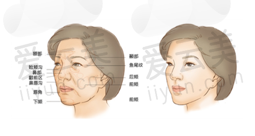 综合评价