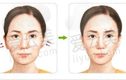北京丽星翼美魏志香医生